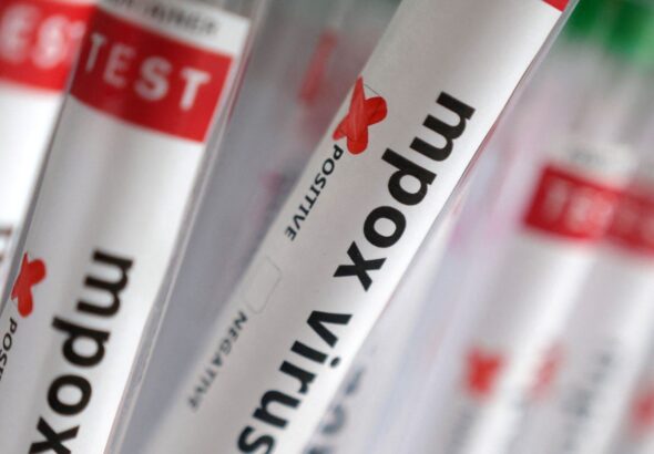 Sobe para 140 número de casos confirmados de Mpox no país, em 2026