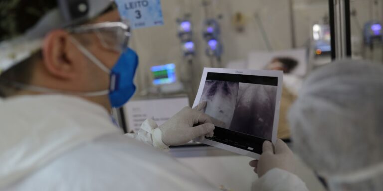 Broncopneumonia: entenda quadro que causou internação de Bolsonaro