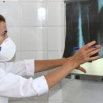 OMS recomenda testes de diagnóstico rápido para erradicar tuberculose