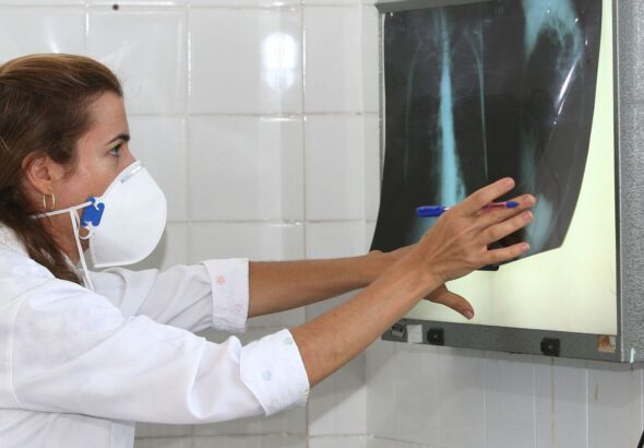 OMS recomenda testes de diagnóstico rápido para erradicar tuberculose
