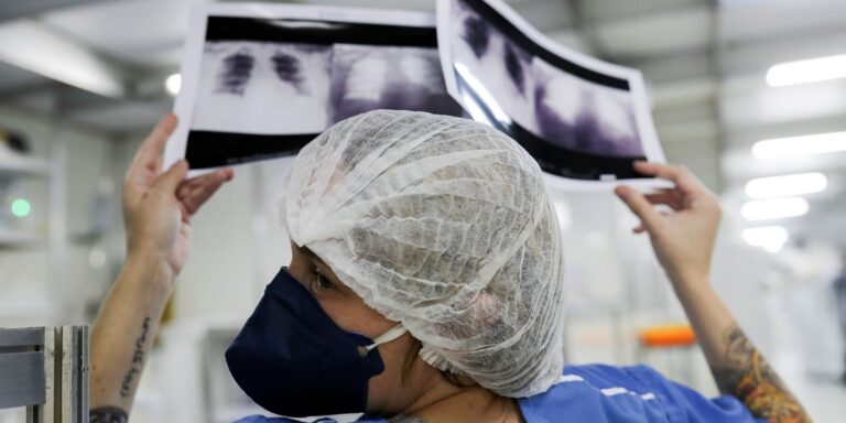 Diagnóstico tardio dá poucas chances de cura para o câncer de pulmão